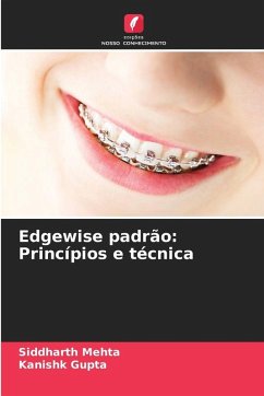 Cover Edgewise padrão: Princípios e técnica