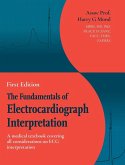 The Fundamentals of Electrocardiograph Interpretation
