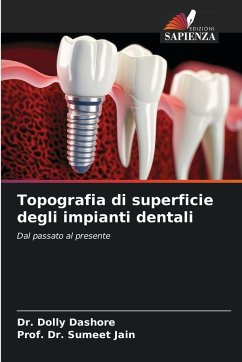 Cover Topografia di superficie degli impianti dentali