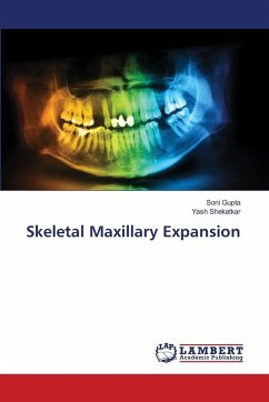 Skeletal Maxillary Expansion - Gupta, Soni;Shekatkar, Yash
