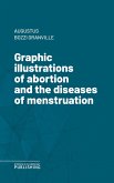 Graphic illustrations of abortion and the diseases of menstruation (eBook, ePUB)