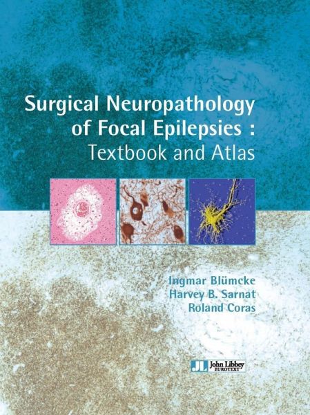 Surgical Neuropathology of Focal Epilepsies (eBook, ePUB)