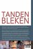 Tanden Bleken - Bild 2