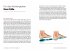 Hallux Valgus - Nachhaltige Hilfe ohne... - Bild 5